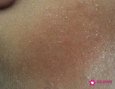 洗脸之后为什么会感觉白了