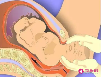 如何知道自己快临盆了