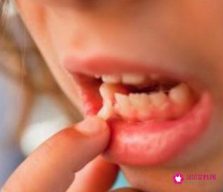 男人梦见自己下边的牙齿掉了预示什么