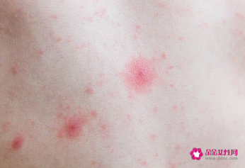 为什么皮肤变细腻了