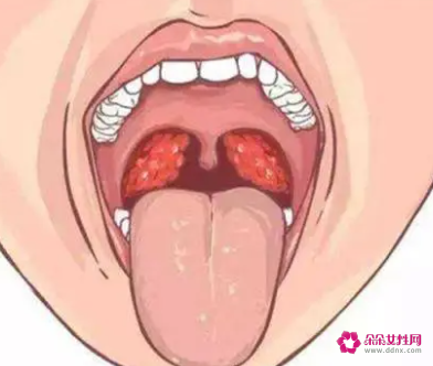 宝宝腺样体肥大有什么危害