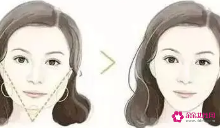 脸部瘦脸针的注意事项