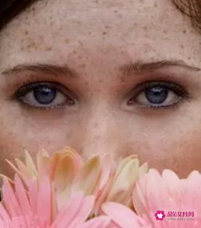 色斑怎么改善