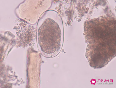 霉菌对人体的危害有哪些
