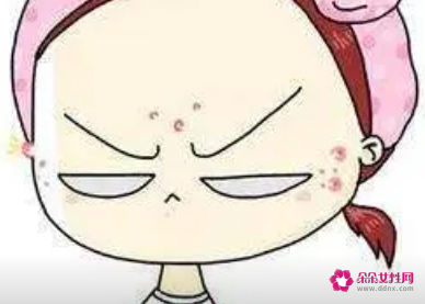 青春痘怎么调理好