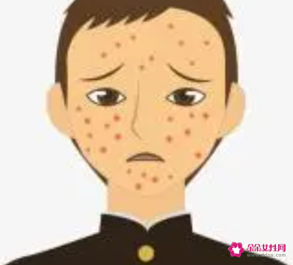 秋冬交替脸上起红疙瘩