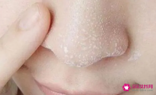 用盐水洗脸好不好