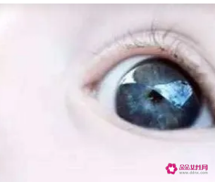 眼皮受伤了怎么处理