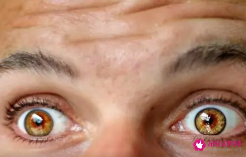 男人如何消除皱纹