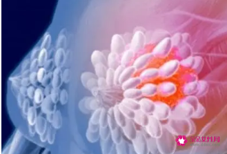 乳房硬块怎么通乳