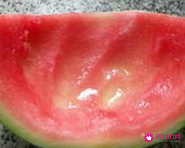 黑木耳汤高压锅烧多久