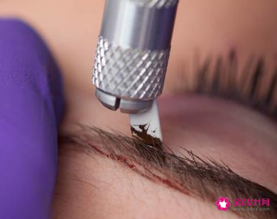 为什么医生不建议女生纹眉