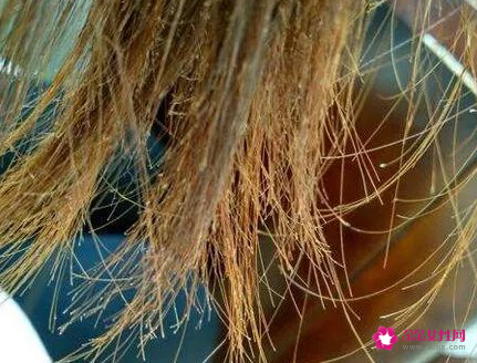 为什么头发会分叉