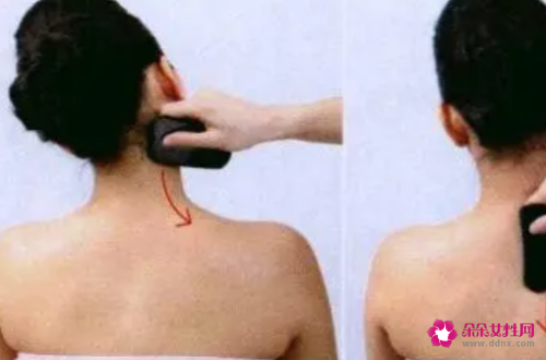 背部刮痧对身体有什么好处