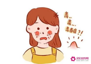 青春期脸上长痘痘怎么调理排毒祛痘
