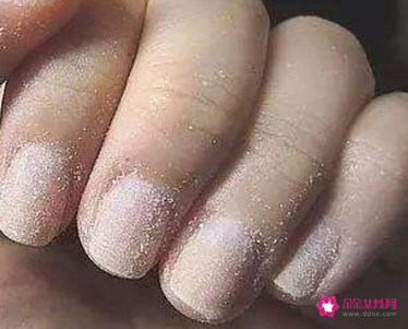 指甲会不会吸收营养