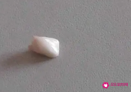 梦到掉牙齿是什么预兆周公解梦