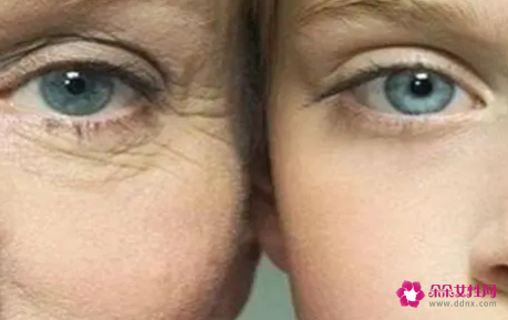 去除皱纹的最好的办法