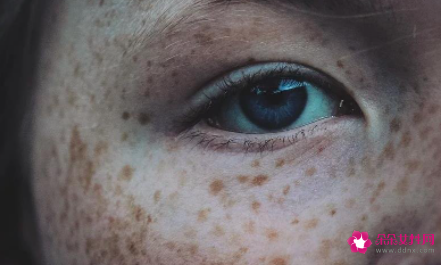 脸颊两边斑点越来越多怎么回事