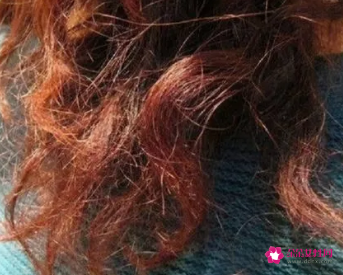 头发毛躁怎么办小技巧