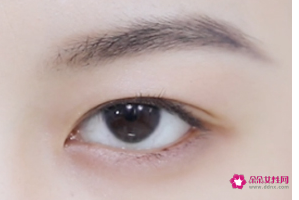 内双的人是眼皮松弛吗