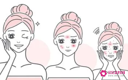 面膜使用后的护肤步骤