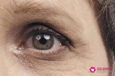 去除皱纹的最好的办法