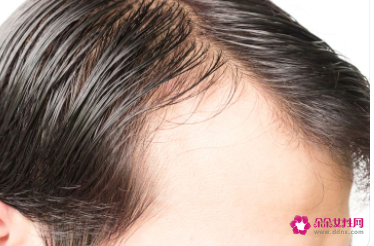 怎样给头发做营养护理