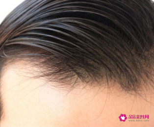 发际线高不想剪刘海