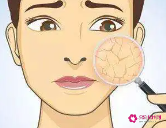 皮肤干燥缺水会出现哪些问题