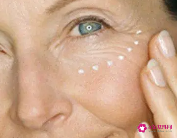 女人脸部长皱纹该怎么办