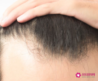 发际线高不想剪刘海