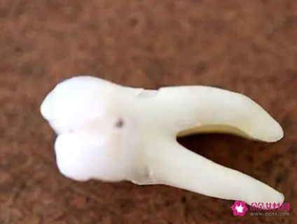 梦到掉牙齿是什么预兆周公解梦