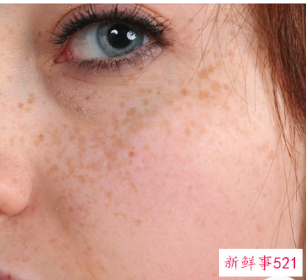 脸上有斑用什么可以去掉的