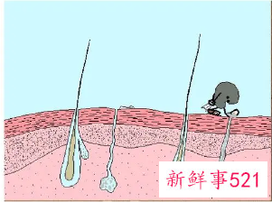 保护皮肤的好处