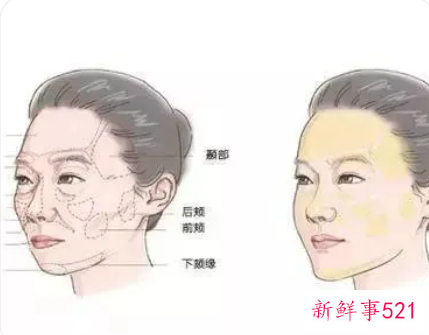 让脸颊饱满的方法