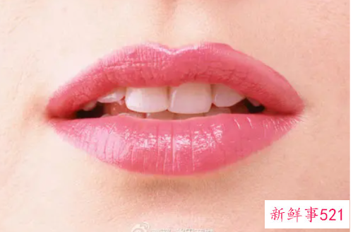 纹唇后怎么护理容易留色