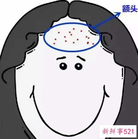 脸颊额头长痘的原因及调理方法