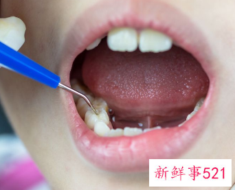 口腔溃疡怎么办最快愈合小偏方