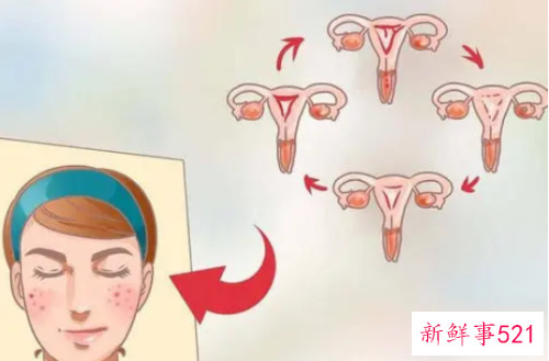 生理期痘痘的诱因及治疗方法