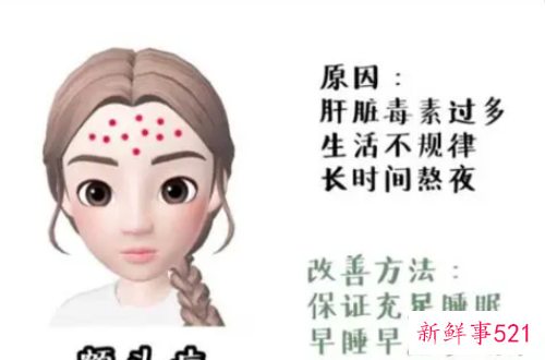 脸颊额头长痘的原因及调理方法