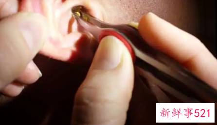 自己挖耳屎有哪些小技巧