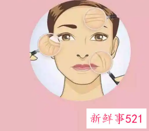 线雕祛皱安全吗