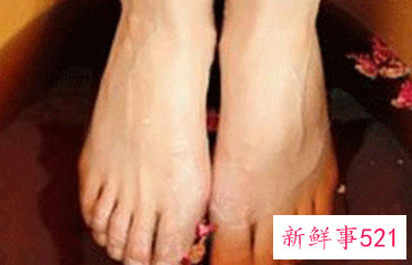 泡脚可以祛痘吗