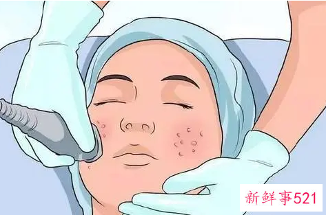 为什么要做深度清洁