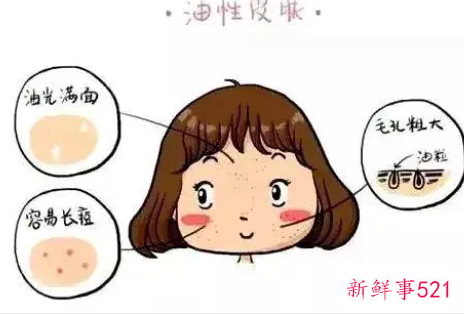 混油皮痘痘肌怎么改善