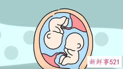 孕妇怀双胞胎肚子会比较大吗