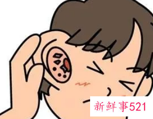 怎么清理耳屎好
