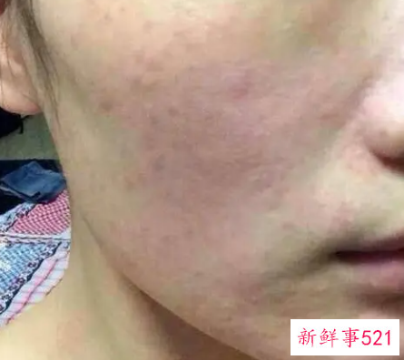 女性全身皮肤粗糙