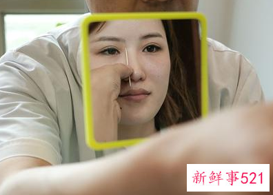 线雕隆鼻有什么后遗症